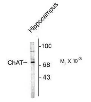 WB analysis of rat brain tissue lysate using GTX30990 Choline Acetyltransferase antibody.