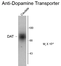 Western blot of human caudate lysate showing specific immunolabeling of the ~88k DAT protein using Dopamine Transporter antibody,C-Term (GTX30998)