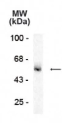 WB analysis of rat hippocampus (hipp) tissue using GTX31004 GABA A Receptor alpha 5 antibody. Dilution : 1:1000