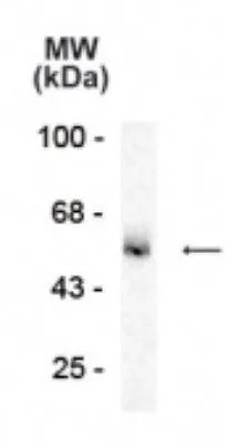 WB analysis of rat hippocampus (hipp) tissue using GTX31004 GABA A Receptor alpha 5 antibody. Dilution : 1:1000 WB analysis of rat hippocampus (hipp) tissue using GTX31004 GABA A Receptor alpha 5 antibody. Dilution : 1:1000