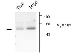 WB analysis of rat thalamus (thal) and hippocampus (hipp) tissue using GTX31004 GABA A Receptor alpha 5 antibody.
