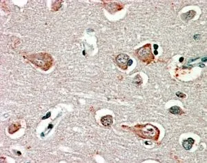 IHC-P analysis of human cortex using GTX31010 GABA A Receptor beta 3 antibody, Internal. Antigen retrieval : citrate buffer pH 6 Dilution : 2.5microg/ml IHC-P analysis of human cortex using GTX31010 GABA A Receptor beta 3 antibody, Internal. Antigen retrieval : citrate buffer pH 6 Dilution : 2.5microg/ml