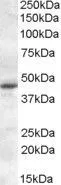 WB analysis of rat retina lysate using GTX31054 Melatonin Receptor 1A antibody, Internal. Dilution : 0.1microg/ml Loading : 35microg protein in RIPA buffer WB analysis of rat retina lysate using GTX31054 Melatonin Receptor 1A antibody, Internal. Dilution : 0.1microg/ml Loading : 35microg protein in RIPA buffer