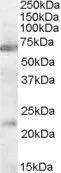 WB analysis of rat brain lysate using GTX31078 AChR alpha 4 antibody, Internal. Dilution : 0.3microg/ml Loading : 35microg protein in RIPA buffer WB analysis of rat brain lysate using GTX31078 AChR alpha 4 antibody, Internal. Dilution : 0.3microg/ml Loading : 35microg protein in RIPA buffer