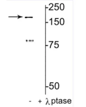 WB analysis of rat hippocampal lysate using GTX31086 NMDAR2B (phospho Tyr1472) antibody. Lane 1 : without lambda phosphatase Lane 2 : lysate treatment with lambda phosphatase (400 units/100uL lysate for 30 min) WB analysis of rat hippocampal lysate using GTX31086 NMDAR2B (phospho Tyr1472) antibody. Lane 1 : without lambda phosphatase Lane 2 : lysate treatment with lambda phosphatase (400 units/100uL lysate for 30 min)