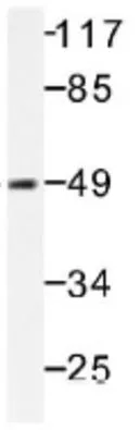 WB analysis of COLO205 cell lysate using GTX31113 Tau (phospho Ser235) antibody. WB analysis of COLO205 cell lysate using GTX31113 Tau (phospho Ser235) antibody.