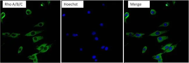 ICC/IF analysis of NIH-3T3 cells using GTX31128 RhoA + RhoB + RhoC antibody [1A11-4G10]. Fixation : Formalin Permeabilization : 0.1% Triton X-100 in TBS for 10 minutes Dilution : 1:100 for at least 1 hour at room temperature