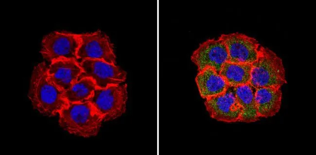 ICC/IF analysis of A431 cells using GTX31128 RhoA + RhoB + RhoC antibody [1A11-4G10]. Cells were probed without (left) or with(right) an antibody. Green : Primary antibody Blue : Nuclei Red : Actin Fixation : Formalin Permeabilization : 0.1% Triton X-100 in TBS for 5-10 minute Dilution : 1:50 and incubated overnight
