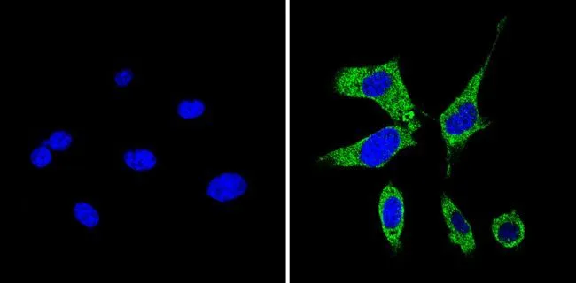 ICC/IF analysis of NIH-3T3 cells using GTX31128 RhoA + RhoB + RhoC antibody [1A11-4G10]. Cells were probed without (left) or with(right) an antibody. Green : Primary antibody Blue : Nuclei Fixation : Formalin Permeabilization : 0.1% Triton X-100 in TBS for 5-10 minute Dilution : 1:50 and incubated overnight