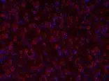 Immunofluorescent staining in brain section of wild-type B6 adult mouse (P-45) using anti-TPH2 antibody (GTX31130) at a dilution of 1:100.