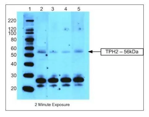 Western Blot analysis of TPH2 in human brain tissue extracts using anti-TPH2 antibody (GTX31130).