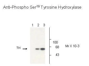 Western Blot: Tyrosine Hydroxylase (phospho Ser19) Antibody [GTX31131] - Non-phospho-recombinant tyrosine hydroxylase (Lane 1), PC-12 cell lysate (Lane 2), and PC-12 cell lysate stimulated with KCl, 30 mM for 10 min (Lane 3) showing specific immunolabeling of the ~60k tyrosine hydroxylase phosphorylated at Ser19.
