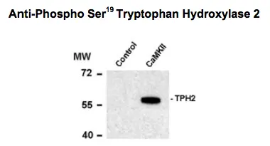Western blot of recombinant tryptophan hydroxylase incubated in the absence (Control) and presence of Ca2+/calmodulin dependent kinase II (CaMKII) showing specific immunolabeling of the ~55k tryptophan hydroxylase protein phosphorylated at Ser19 using TPH2 (phospho Ser19) antibody (GTX31131) Western blot of recombinant tryptophan hydroxylase incubated in the absence (Control) and presence of Ca2+/calmodulin dependent kinase II (CaMKII) showing specific immunolabeling of the ~55k tryptophan hydroxylase protein phosphorylated at Ser19 using TPH2 (phospho Ser19) antibody (GTX31131)