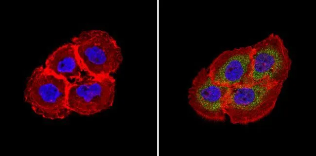 ICC/IF analysis of A431 cells using GTX31144 RhoA + RhoC antibody [1B3-4A10]. Cells were probed without (left) or with(right) an antibody. Green : Primary antibody Blue : Nuclei Red : Actin Fixation : Formalin Permeabilization : 0.1% Triton X-100 in TBS for 5-10 minute Dilution : 1:100 and incubated overnight at 4oC