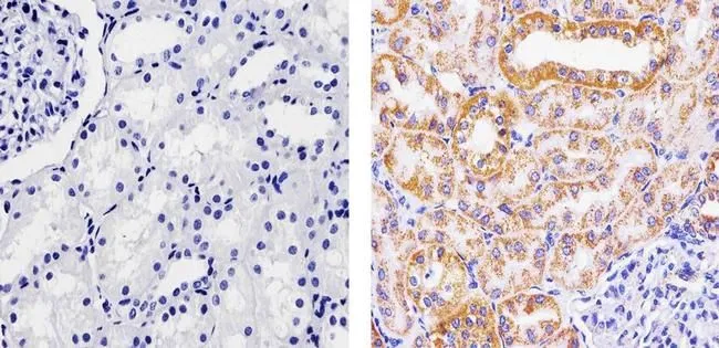 IHC-P analysis of human kidney tissue using GTX31147 SOD2 antibody [1H6]. Right : Primary antibody Left : Negative control without primary antibody Antigen retrieval : 10mM sodium citrate (pH 6.0), microwaved for 8-15 min Dilution : 1:100