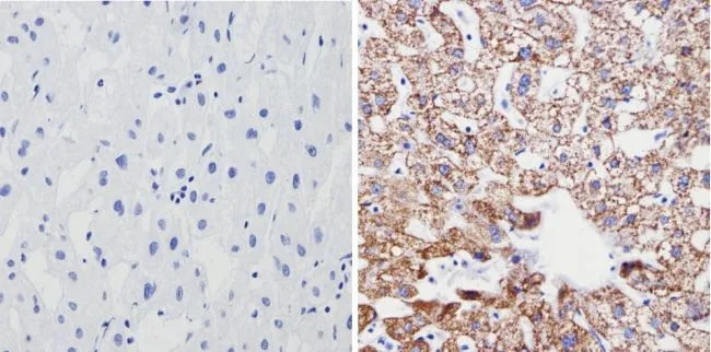 IHC-P analysis of human liver tissue using GTX31147 SOD2 antibody [1H6]. Right : Primary antibody Left : Negative control without primary antibody Antigen retrieval : 10mM sodium citrate (pH 6.0), microwaved for 8-15 min Dilution : 1:200