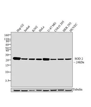 WB analysis of whole cell extracts (30 microg lysate) of HepG2 (Lane 1), Jurkat (Lane 2), K562 (Lane 3), HeLa (Lane 4), U-87 MG (Lane 5), COLO 205 (Lane 6), HEK293 (Lane 7) and HUVEC (Lane 8) using GTX31147 SOD2 antibody [1H6]. Dilution : 1-2 microg/ml