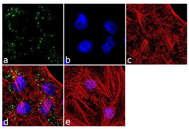 ICC/IF analysis of HeLa cells using GTX31147 SOD2 antibody [1H6]. Panel e is a no primary antibody control. Green : Primary antibody Blue : Nuclei Red : Actin Fixation : 4% paraformaldehyde Permeabilization : 0.1% Triton? X-100 for 10 minutes Dilution : 2 microg/ml in 0.1% BSA incubated for 3 hours at room temperature