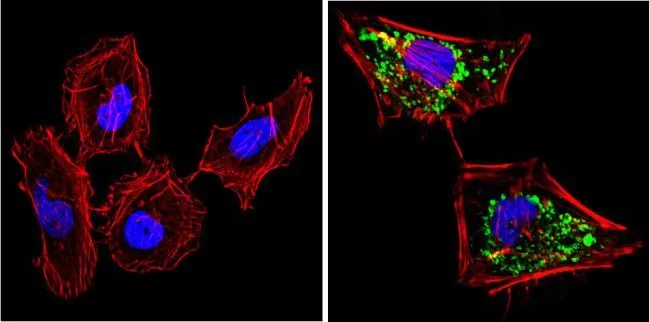 ICC/IF analysis of HeLa cells using GTX31147 SOD2 antibody [1H6]. Cells were probed without (left) or with(right) an antibody. Green : Primary antibody Blue : Nuclei Red : Actin Fixation : Formalin Permeabilization : 0.1% Triton X-100 in TBS for 5-10 minute Dilution : 1:200 incubated overnight at 4 oC in a humidified chamber