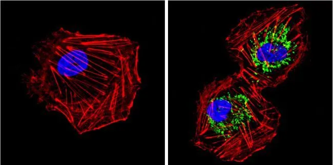 ICC/IF analysis of HUVEC cells using GTX31147 SOD2 antibody [1H6]. Cells were probed without (left) or with(right) an antibody. Green : Primary antibody Blue : Nuclei Red : Actin Fixation : Formalin Permeabilization : 0.1% Triton X-100 in TBS for 5-10 minute Dilution : 1:200 incubated overnight at 4 oC in a humidified chamber