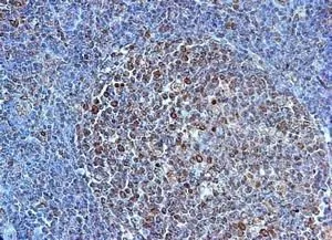 IHC-P analysis of human tonsil tissue using GTX31243 TLR4 antibody. IHC-P analysis of human tonsil tissue using GTX31243 TLR4 antibody.