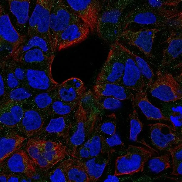 ICC/IF analysis of Caco-2 cells using GTX31250 TNF receptor II antibody(green). Counterstained with actin, red and nuclei, blue ICC/IF analysis of Caco-2 cells using GTX31250 TNF receptor II antibody(green). Counterstained with actin, red and nuclei, blue