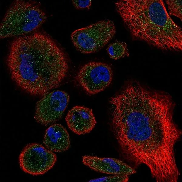 ICC/IF analysis of PC3 cells using GTX31250 TNF receptor II antibody(green). Counterstained with actin, red and nuclei, blue
