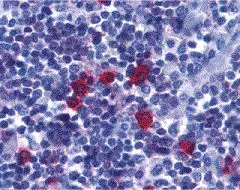 IHC analysis of human tonsil tissue using GTX31252 BAFF Receptor antibody. IHC analysis of human tonsil tissue using GTX31252 BAFF Receptor antibody.