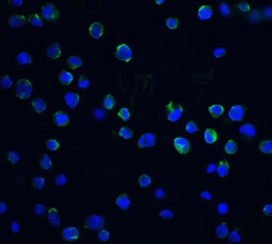 ICC/IF analysis of K562 cells using GTX31261 DFFB antibody. Working concentration : 20 microg/ml