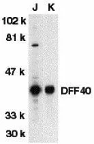 WB analysis of Jurkat (J) and K562 (K) whole cell lysates using GTX31262 DFFB antibody. Working concentration : 1:500 WB analysis of Jurkat (J) and K562 (K) whole cell lysates using GTX31262 DFFB antibody. Working concentration : 1:500