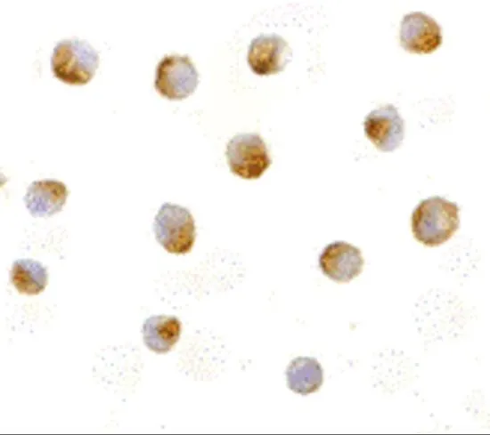 ICC/IF analysis of Jurkat cells using GTX31262 DFFB antibody. Working concentration : 5 microg/ml