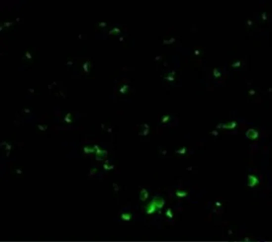 ICC/IF analysis of Jurkat cells using GTX31262 DFFB antibody. Working concentration : 20 microg/ml