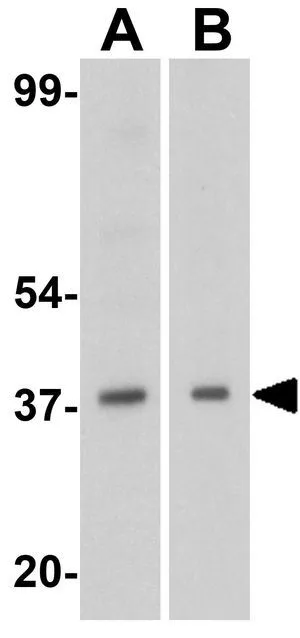 WB analysis of (A) K562 and (B) Jurkat cell lysate using GTX31263 DFFB antibody. Working concentration : 1 microg/ml WB analysis of (A) K562 and (B) Jurkat cell lysate using GTX31263 DFFB antibody. Working concentration : 1 microg/ml