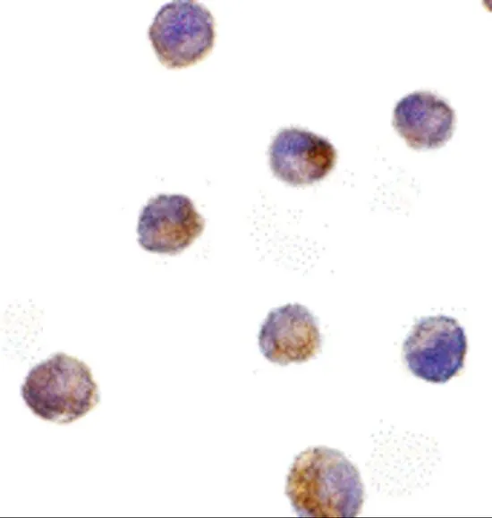 ICC/IF analysis of K562 cells using GTX31263 DFFB antibody. Working concentration : 10 microg/ml