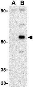 WB analysis of Raji cell lysate in (A) the presence and (B) the absence of blocking peptide using GTX31267 AVEN antibody. Working concentration : 1 microg/ml WB analysis of Raji cell lysate in (A) the presence and (B) the absence of blocking peptide using GTX31267 AVEN antibody. Working concentration : 1 microg/ml