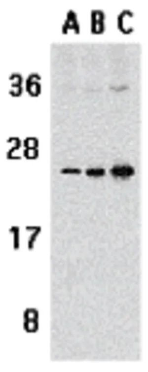 WB analysis of Jurkat cell lysate using GTX31268 APRIL antibody. Working concentration : 1 microg/ml (A), 2 microg/ml (B), and 4 microg/ml WB analysis of Jurkat cell lysate using GTX31268 APRIL antibody. Working concentration : 1 microg/ml (A), 2 microg/ml (B), and 4 microg/ml
