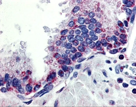 IHC-P analysis of human prostate tissue using GTX31268 APRIL antibody. Working concentration : 10 microg/ml