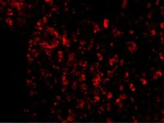 IHC-P analysis of human spleen tissue using GTX31269 AVEN antibody. Working concentration : 20 microg/ml
