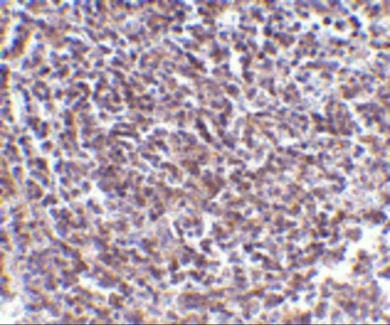 IHC-P analysis of human spleen tissue using GTX31269 AVEN antibody. Working concentration : 5 microg/ml