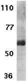 WB analysis of Raji cell lysate using GTX31271 IL21 Receptor antibody. Working concentration : 1 microg/ml WB analysis of Raji cell lysate using GTX31271 IL21 Receptor antibody. Working concentration : 1 microg/ml