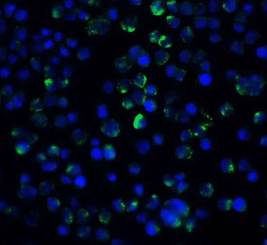 ICC/IF analysis of A431 cells using GTX31271 IL21 Receptor antibody. Working concentration : 20 microg/ml