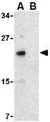 WB analysis of RAW264.7 cell lysate in the (A) absence and (B) presence of blocking peptide using GTX31273 NKIRAS2 antibody. Working concentration : 1 microg/ml WB analysis of RAW264.7 cell lysate in the (A) absence and (B) presence of blocking peptide using GTX31273 NKIRAS2 antibody. Working concentration : 1 microg/ml
