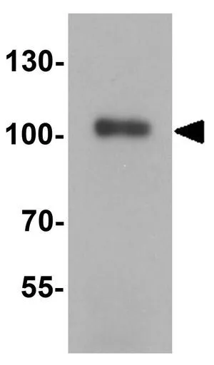 WB analysis of human testis tissue lysate using GTX31274 KAP1 antibody. Working concentration : 1 ug/ml