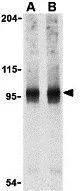 WB analysis of PC-3 cell lysate using GTX31277 NALP2 antibody. Working concentration : (A) 1 and (B) 2 microg/ml WB analysis of PC-3 cell lysate using GTX31277 NALP2 antibody. Working concentration : (A) 1 and (B) 2 microg/ml