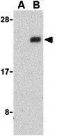 WB analysis of human brain cell lysates in the presence (A) or absence (B) of blocking peptide using GTX31283 NADE antibody. Working concentration : 1 microg/ml WB analysis of human brain cell lysates in the presence (A) or absence (B) of blocking peptide using GTX31283 NADE antibody. Working concentration : 1 microg/ml