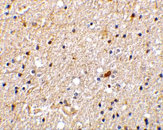 IHC-P analysis of human brain tissue using GTX31283 NADE antibody. Working concentration : 2 microg/ml