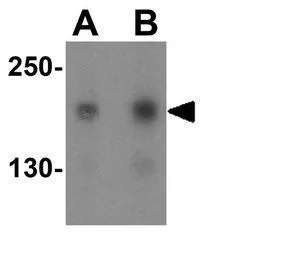 WB analysis of Jurkat cell lysate using GTX31286 TSC2 antibody. Working concentration : (A) 1 and (B) 2 microg/ml WB analysis of Jurkat cell lysate using GTX31286 TSC2 antibody. Working concentration : (A) 1 and (B) 2 microg/ml
