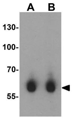 WB analysis of human brain tissue lysate using GTX31288 CRMP1 antibody. Working concentration : (A) 1 and (B) 2 microg/ml WB analysis of human brain tissue lysate using GTX31288 CRMP1 antibody. Working concentration : (A) 1 and (B) 2 microg/ml