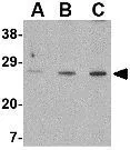 WB analysis of PC-3 cell lysate using GTX31292 XBP1 antibody. Working concentration : (A) 0.5, (B) 1, and (C) 2 microg/ml
