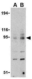 WB analysis of mouse spleen tissue lysate using GTX31294 TLR9 antibody. Working concentration : (A) 0.5 and (B) 1 microg/ml